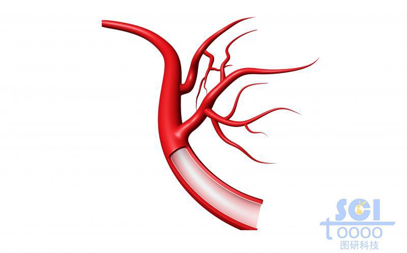 帶切口帶毛細血管分支的血管結構