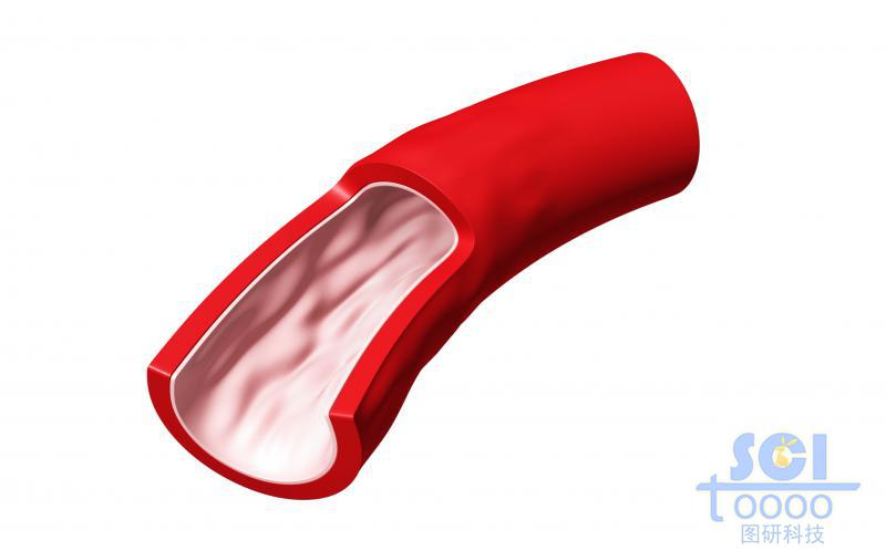 單根血管前段帶切開結構