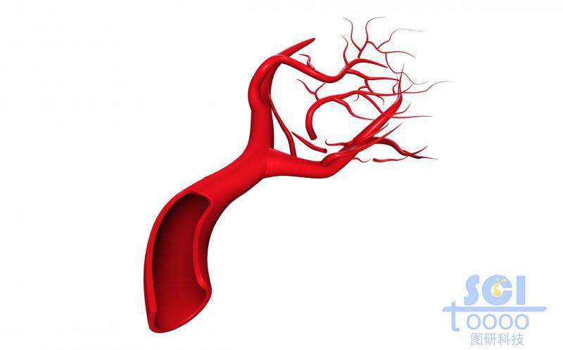 帶切口帶毛細(xì)血管分支的血管結(jié)構(gòu)
