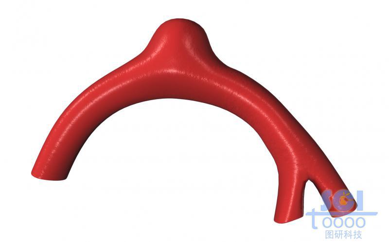 帶腫瘤結(jié)構(gòu)的血管