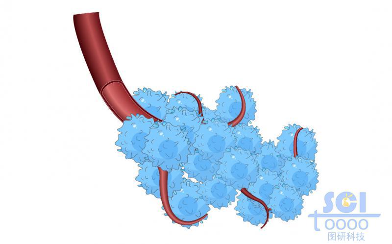 血管與癌細(xì)胞群簇