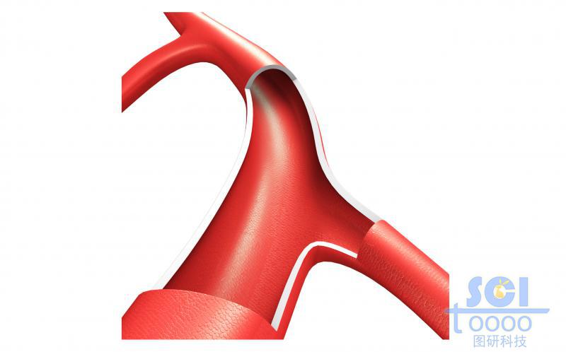 帶分支血管結(jié)構(gòu)