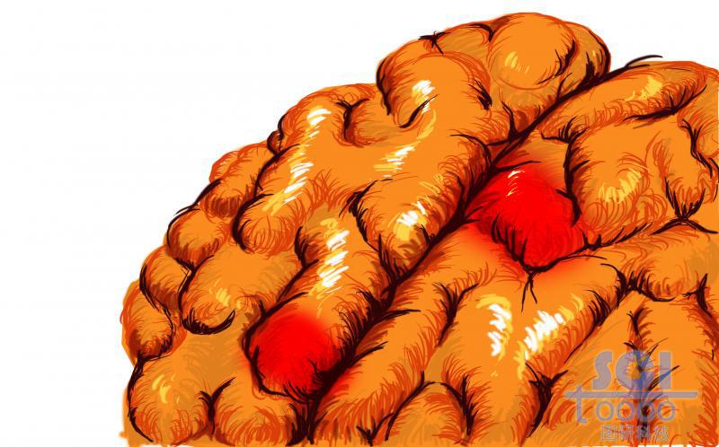 大腦結(jié)構(gòu)